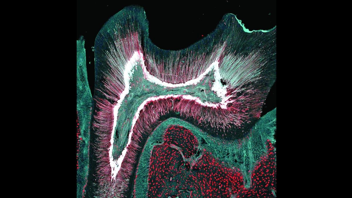 Vědci mají atlas zubních buněk, chrup by se mohl léčit sám